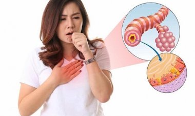 Bệnh viêm phế quản: Bài thuốc trị viêm phế quản