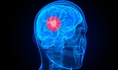 Nghiên cứu mới Bệnh Ung Thư: Liệu pháp miễn dịch cải thiện thời gian sống thêm ở bệnh nhân ung thư