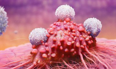 Bệnh ung thư là gì: Những điều cơ bản cần biết về ung thư