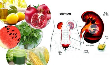 Điều trị và ngăn ngừa sỏi thận hiệu quả với những loại đồ uống này