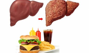 Những thực phẩm gây hại đến gan nên tránh xa