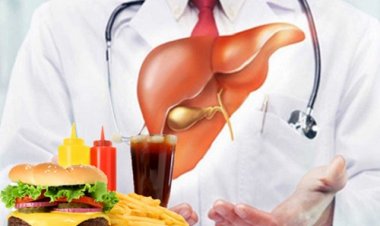 7 loại thực phẩm là kẻ thù của người mắc gan nhiễm mỡ