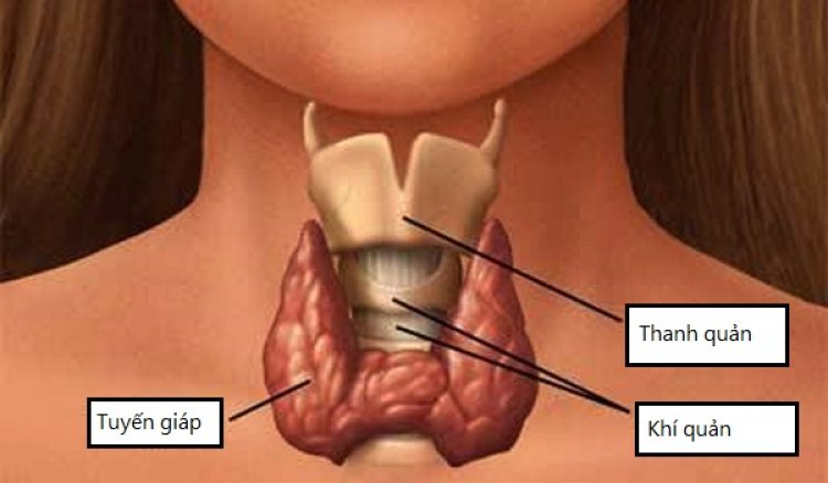 Bài thuốc hay: Đông y hỗ trợ trị suy giáp trạng