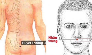 Thượng mã phong: Vì sao đàn ông thường đột tử