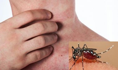 Lo ngại sốt xuất huyết