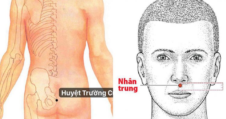 Thượng mã phong: Vì sao đàn ông thường đột tử