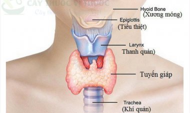 Bài thuốc hỗ trợ trị cường giáp