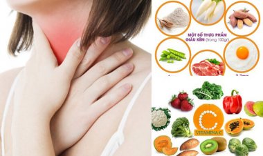 Bệnh ung thư vòm họng nên và không nên ăn gì?