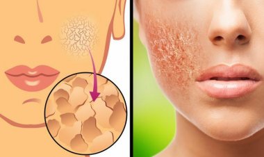 Lười tắm trong mùa đông khiến bạn có thể mắc 10 vấn đề này