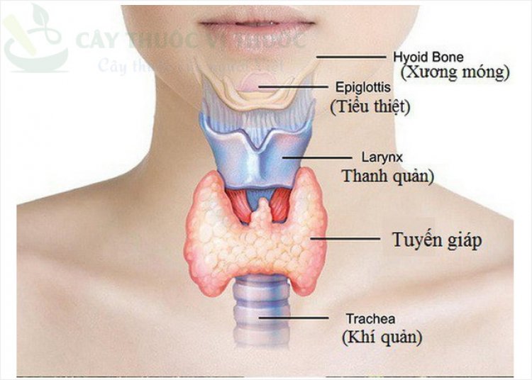 Bài thuốc hỗ trợ trị cường giáp