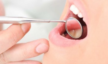 Khô miệng, chữa thế nào?