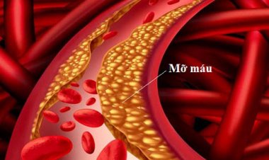 Món ăn là bài thuốc quý cho người bệnh mỡ máu