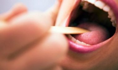 Dấu hiệu ung thư miệng bạn cần đi khám ngay