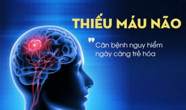 Thiếu máu não: Nguyên nhân gây thiếu máu não