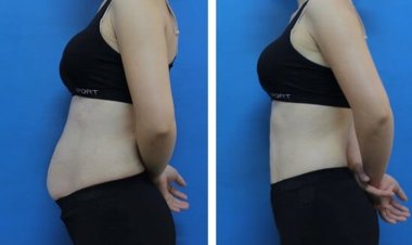 Mỡ bụng nhiều hãy dùng những thực phẩm giúp giảm mỡ bụng này