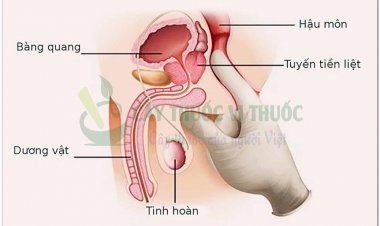 Hỏi đáp bệnh Ung Thư: Phương pháp điều trị ung thư tiền liệt tuyến bằng nội tiết