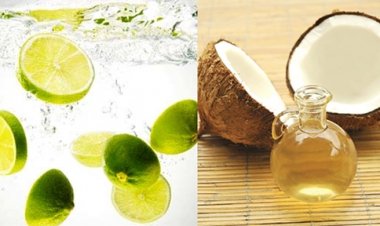 5 cách trị bỏng đơn giản tại nhà