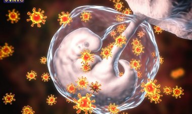 4 bài thuốc nam hỗ trợ chữa bệnh Rubella hiệu quả