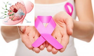 Hiểu lầm tai hại về bệnh ung thư vú