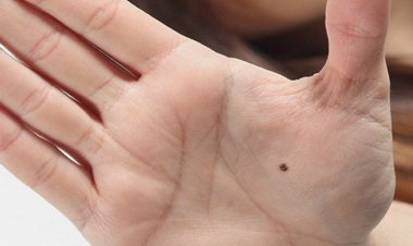3 nốt ruồi bí mật trên cơ thể ẩn chứa tài lộc, chiêu mộ quý nhân