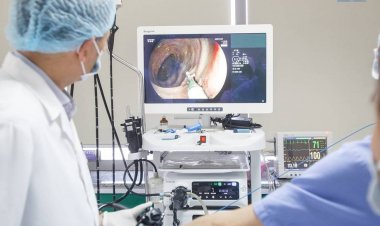 Polyp đại tràng và nguy cơ ung thư đại tràng từ polyp