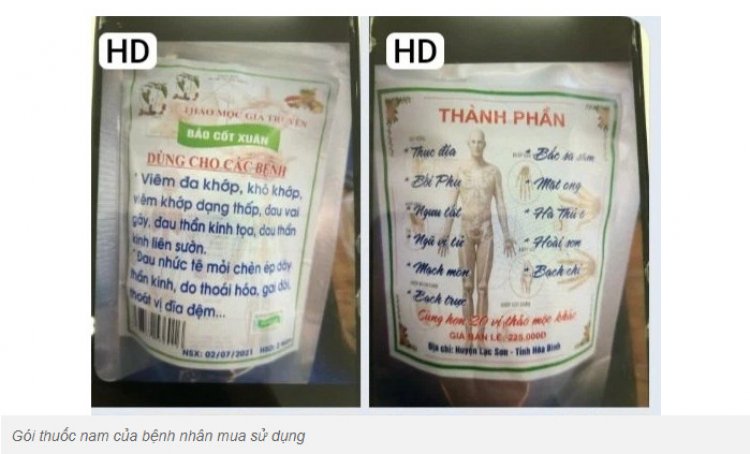 Ngộ độc Paracetamol do sử dụng thuốc nam mua theo lời quảng cáo chữa bách bệnh