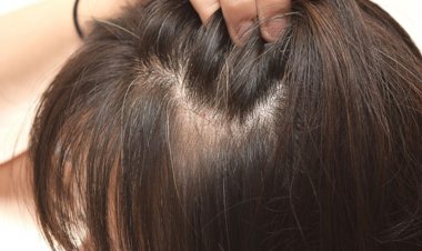 Người tóc bạc, tóc bạc sớm nên dùng thảo dược bài thuốc này