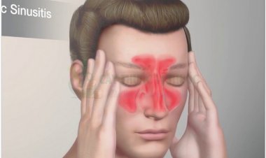 Các bài thuốc Đông y điều trị viêm xoang mũi