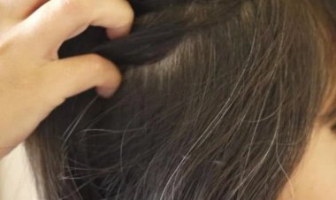 Khí huyết không đủ khiến tóc bạc sớm: Bổ sung 5 loại thực phẩm tác dụng bổ khí, dưỡng huyết ngay để cải thiện thiện sức khỏe, kéo dài thanh xuân