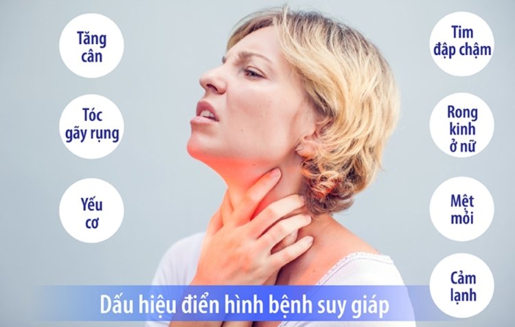 Bệnh tuyến giáp những loại bệnh bướu tuyến giáp thường gặp