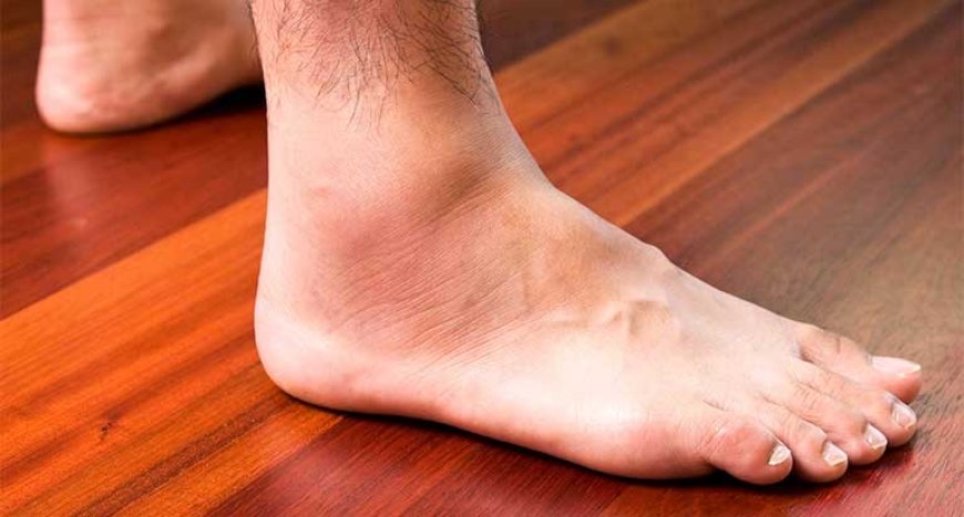 Hai dấu hiếu báo gan đang tổn thương ở lòng bàn chân: Da lòng bàn chân có màu vàng, Tê lòng bàn chân ai đang có dấu hiệu này thì kiểm tra sức khoẻ gan ngay