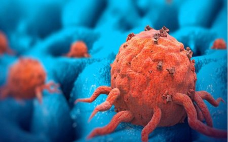 Các Phương Pháp Điều Trị Ung Thư Hiệu Quả