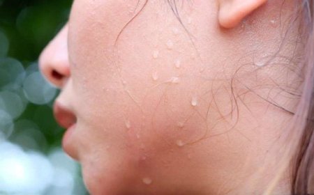 Ung Thư Tuyến Mồ Hôi: Triệu Chứng, Nguyên Nhân và Cách Điều Trị