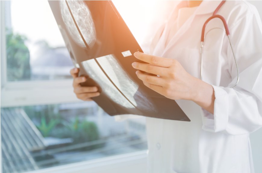 AI Chẩn Đoán Ung Thư Phổi, Vú Gần Như Chính Xác Tuyệt Đối – Bước Tiến Vượt Bậc Từ Hàn Quốc