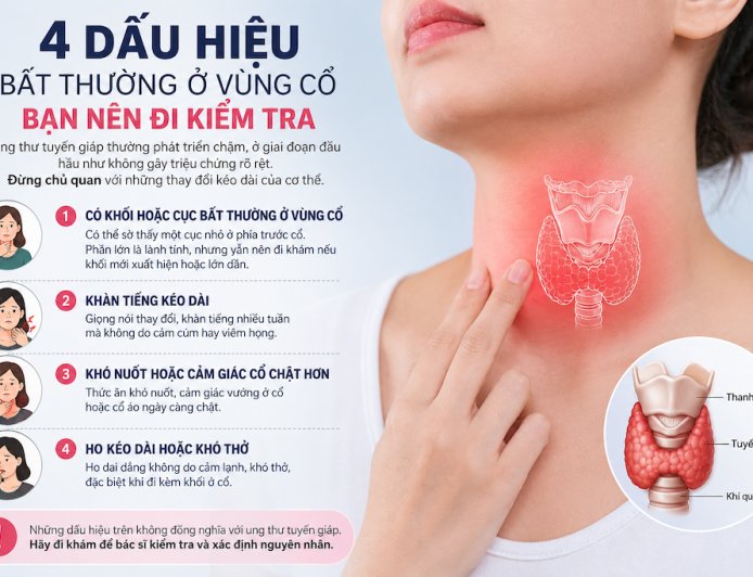 Ung thư tuyến giáp: 4 dấu hiệu bất thường ở vùng cổ cần lưu ý